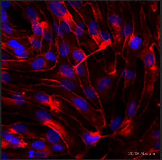 Immunocytochemistry/ Immunofluorescence - Anti-VE Cadherin antibody - Intercellular Junction Marker (ab33168), expandable thumbnail