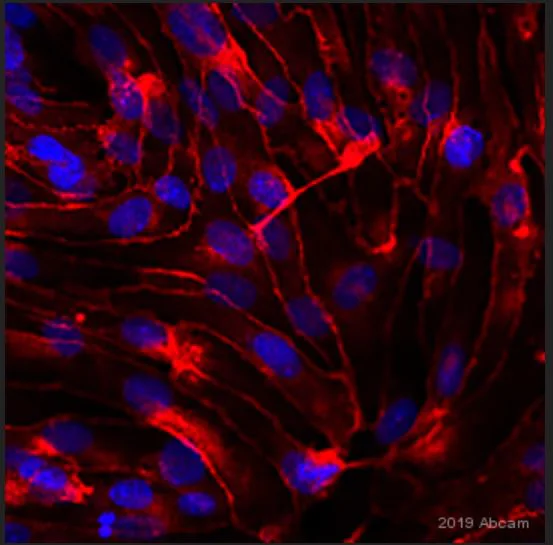 Immunocytochemistry/ Immunofluorescence - Anti-VE Cadherin antibody - Intercellular Junction Marker (AB33168)
