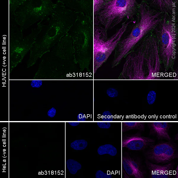 Immunocytochemistry/ Immunofluorescence - Anti-VE Cadherin antibody [RM2022] (AB318152)