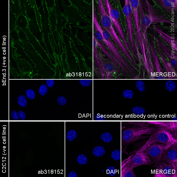 Immunocytochemistry/ Immunofluorescence - Anti-VE Cadherin antibody [RM2022] (AB318152)