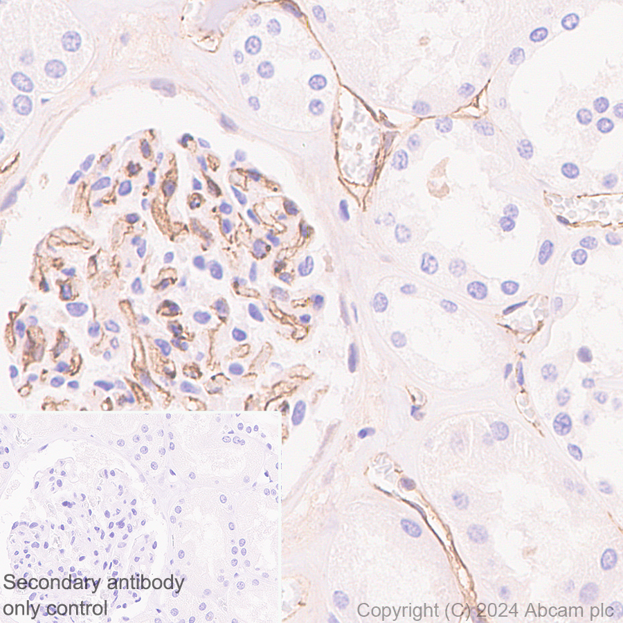 Immunohistochemistry (Formalin/PFA-fixed paraffin-embedded sections) - Anti-VE Cadherin antibody [RM2022] (AB318152)