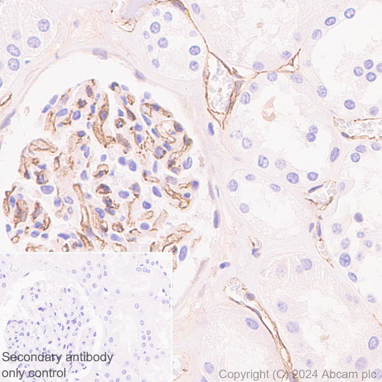 Immunohistochemistry (Formalin/PFA-fixed paraffin-embedded sections) - Anti-VE Cadherin antibody [RM2022] (AB318152)