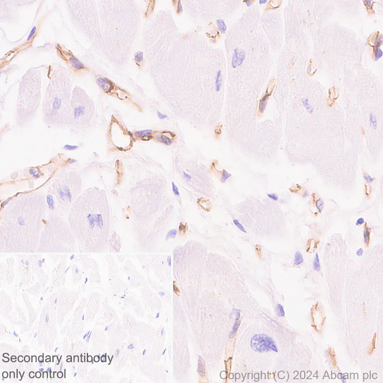 Immunohistochemistry (Formalin/PFA-fixed paraffin-embedded sections) - Anti-VE Cadherin antibody [RM2022] (AB318152)