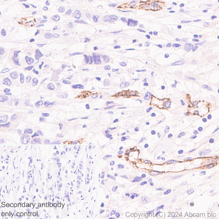Immunohistochemistry (Formalin/PFA-fixed paraffin-embedded sections) - Anti-VE Cadherin antibody [RM2022] (AB318152)
