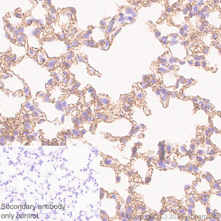 Immunohistochemistry (Formalin/PFA-fixed paraffin-embedded sections) - Anti-VE Cadherin antibody [RM2022] (AB318152)