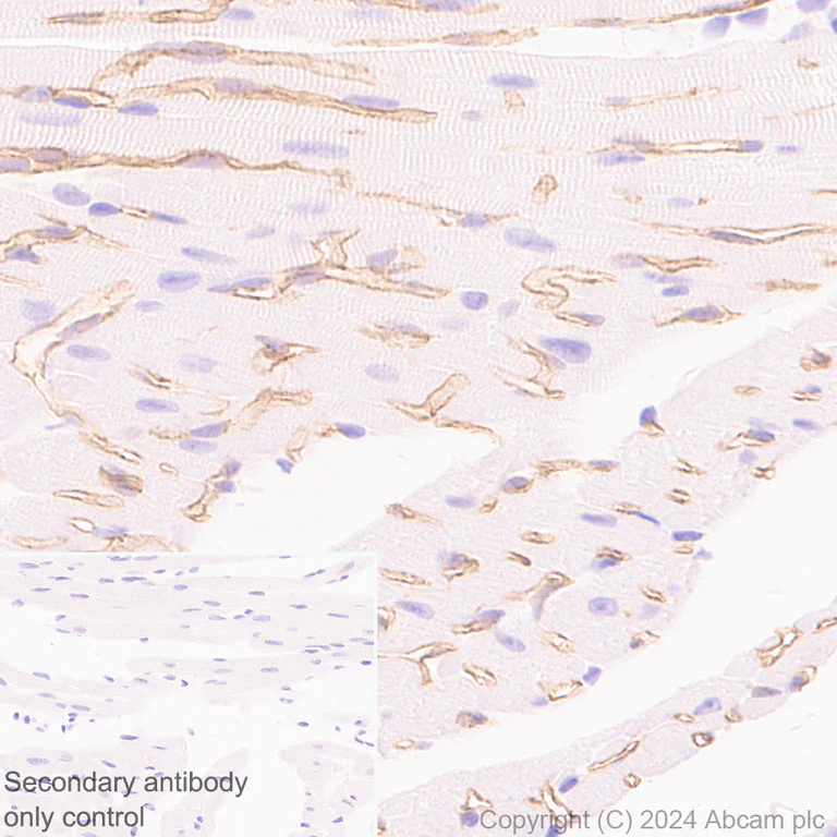 Immunohistochemistry (Formalin/PFA-fixed paraffin-embedded sections) - Anti-VE Cadherin antibody [RM2022] (AB318152)