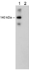 Western blot - Anti-VE Cadherin (phospho Y685) antibody (AB119785)