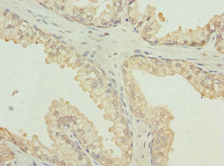 Immunohistochemistry (Formalin/PFA-fixed paraffin-embedded sections) - Anti-VE-PTP antibody (AB229661)