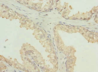 Immunohistochemistry (Formalin/PFA-fixed paraffin-embedded sections) - Anti-VE-PTP antibody (AB229661)