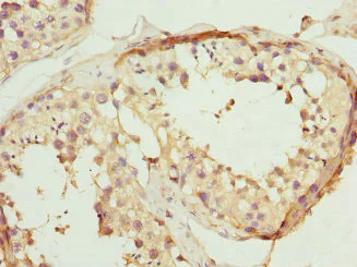 Immunohistochemistry (Formalin/PFA-fixed paraffin-embedded sections) - Anti-VE-PTP antibody (AB229661)