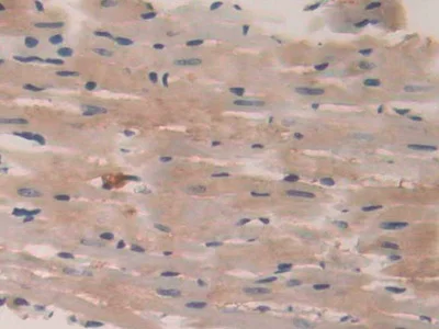 Immunohistochemistry (Formalin/PFA-fixed paraffin-embedded sections) - Anti-VE-PTP antibody (AB231670)