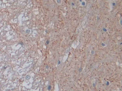 Immunohistochemistry (Formalin/PFA-fixed paraffin-embedded sections) - Anti-VE-PTP antibody (AB231670)