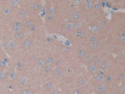 Immunohistochemistry (Formalin/PFA-fixed paraffin-embedded sections) - Anti-VE-PTP antibody (AB231670)