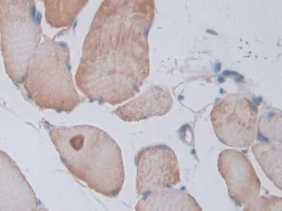 Immunohistochemistry (Formalin/PFA-fixed paraffin-embedded sections) - Anti-VE-PTP antibody (AB231670)