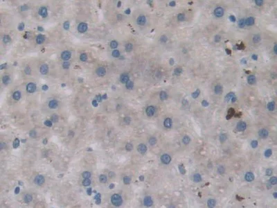 Immunohistochemistry (Formalin/PFA-fixed paraffin-embedded sections) - Anti-VE-PTP antibody (AB231670)