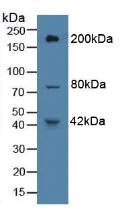 Western blot - Anti-VE-PTP antibody (AB231670)