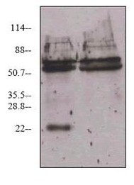 Immunoprecipitation - Anti-VEGF 165A antibody [6B7] (AB69479), expandable thumbnail