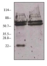 Immunoprecipitation - Anti-VEGF 165A antibody [6B7] (AB69479)