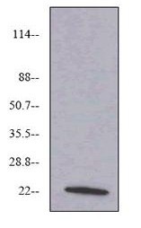 Western blot - Anti-VEGF 165A antibody [6B7] (AB69479), expandable thumbnail