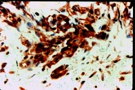 Immunohistochemistry (Formalin/PFA-fixed paraffin-embedded sections) - Anti-VEGF Receptor 1 antibody (AB2350)