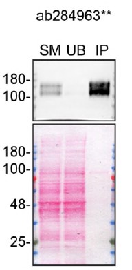Immunoprecipitation - Anti-VEGF Receptor 1 antibody [EPR21886-207] - BSA and Azide free (Capture) (AB284963)
