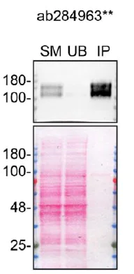 Immunoprecipitation - Anti-VEGF Receptor 1 antibody [EPR21886-207] - BSA and Azide free (Capture) (AB284963)