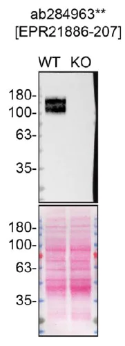 Western blot - Anti-VEGF Receptor 1 antibody [EPR21886-207] - BSA and Azide free (Capture) (AB284963)