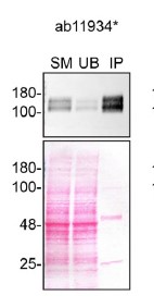 Immunoprecipitation - Anti-VEGF Receptor 1 antibody [EWF] (AB11934)