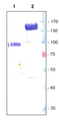 Western blot - Anti-VEGF Receptor 1 antibody [EWF] (AB11934)