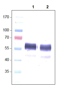 Western blot - Anti-VEGF Receptor 1 antibody [EWF] (AB11934)