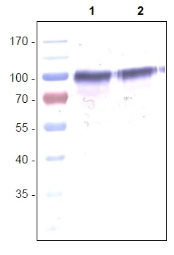 Western blot - Anti-VEGF Receptor 1 antibody [EWF] (AB11934)