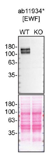 Western blot - Anti-VEGF Receptor 1 antibody [EWF] (AB11934)