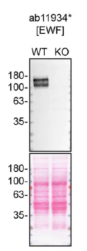 Western blot - Anti-VEGF Receptor 1 antibody [EWF] (AB11934)