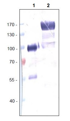 Western blot - Anti-VEGF Receptor 1 antibody [EWI] (AB238632), expandable thumbnail