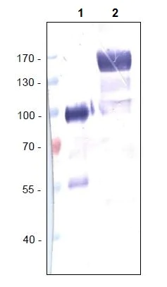 Western blot - Anti-VEGF Receptor 1 antibody [EWI] (AB238632)