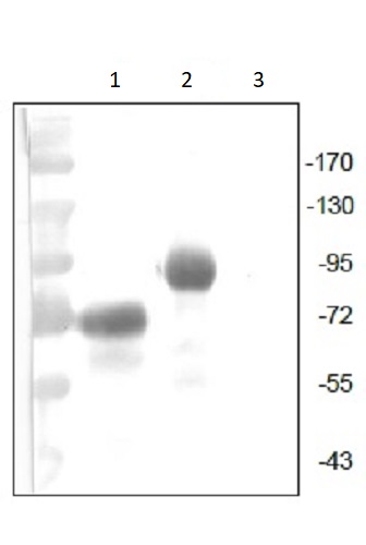 Western blot - Anti-VEGF Receptor 1 antibody [EWI] (AB238632), expandable thumbnail