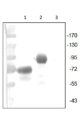Western blot - Anti-VEGF Receptor 1 antibody [EWI] (AB238632)