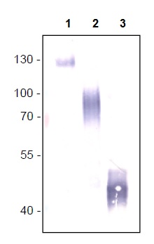 Western blot - Anti-VEGF Receptor 1 antibody [EWI] (AB238632), expandable thumbnail