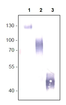 Western blot - Anti-VEGF Receptor 1 antibody [EWI] (AB238632)