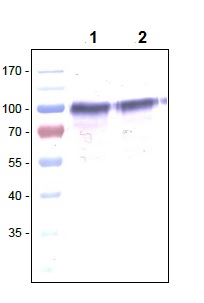 Western blot - Anti-VEGF Receptor 1 antibody [EWI] (AB238632), expandable thumbnail
