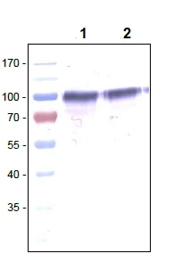 Western blot - Anti-VEGF Receptor 1 antibody [EWI] (AB238632)