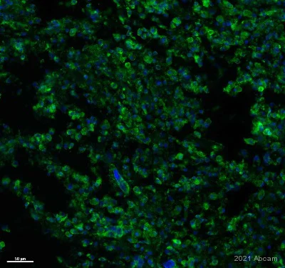 Immunohistochemistry (Formalin/PFA-fixed paraffin-embedded sections) - Anti-VEGF Receptor 1 antibody [Y103] (AB32152)