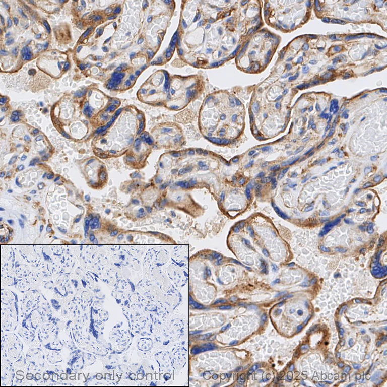 Immunohistochemistry (Formalin/PFA-fixed paraffin-embedded sections) - Anti-VEGF Receptor 1 antibody [Y103] (AB32152)