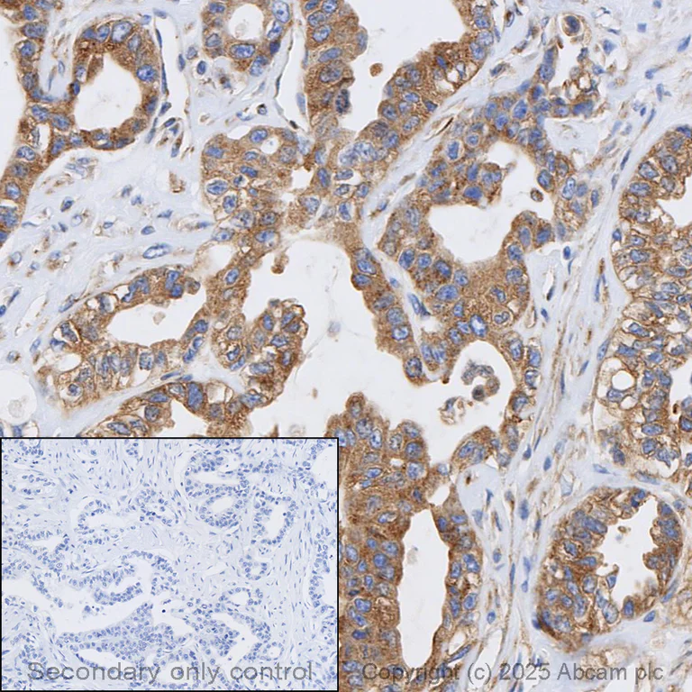 Immunohistochemistry (Formalin/PFA-fixed paraffin-embedded sections) - Anti-VEGF Receptor 1 antibody [Y103] (AB32152)