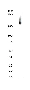 Western blot - Anti-VEGF Receptor 1 antibody [Y103] (AB32152)
