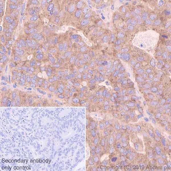 Immunohistochemistry (Formalin/PFA-fixed paraffin-embedded sections) - Anti-VEGF Receptor 1 antibody [Y103] - BSA and Azide free (AB210608)