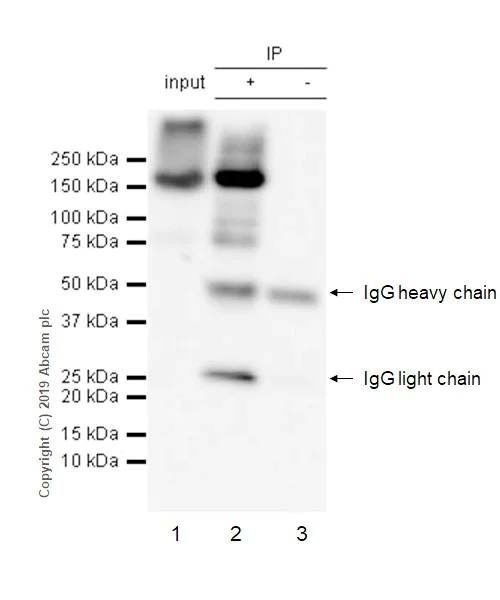 Immunoprecipitation - Anti-VEGF Receptor 1 antibody [Y103] - BSA and Azide free (AB210608)