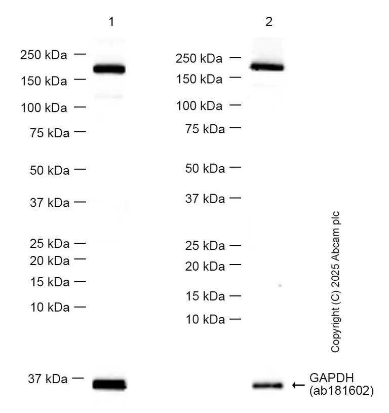 Western blot - Anti-VEGF Receptor 1 antibody [Y103] - BSA and Azide free (AB210608)