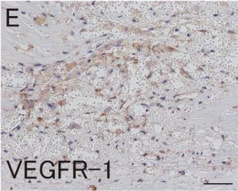Immunohistochemistry (Formalin/PFA-fixed paraffin-embedded sections) - Anti-VEGF Receptor 1 antibody [Y103] - Low endotoxin, Azide free (AB184784)