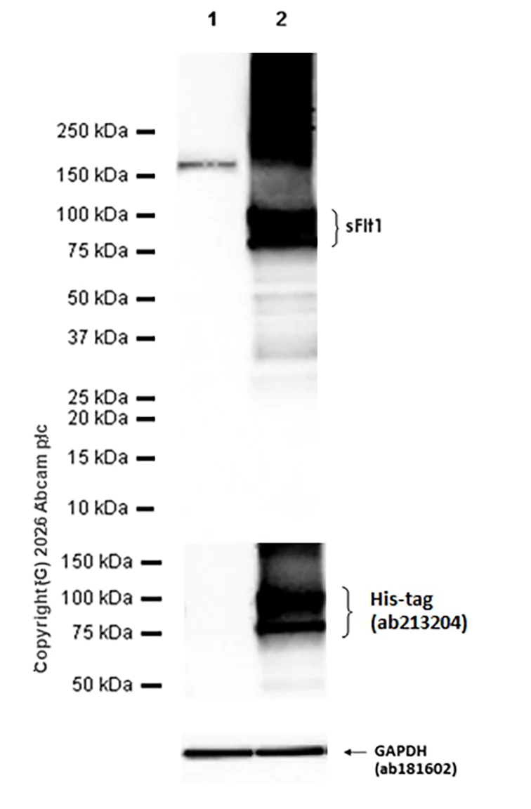 Western blot - Anti-VEGF Receptor 1 antibody [Y103] - Low endotoxin, Azide free (AB184784)